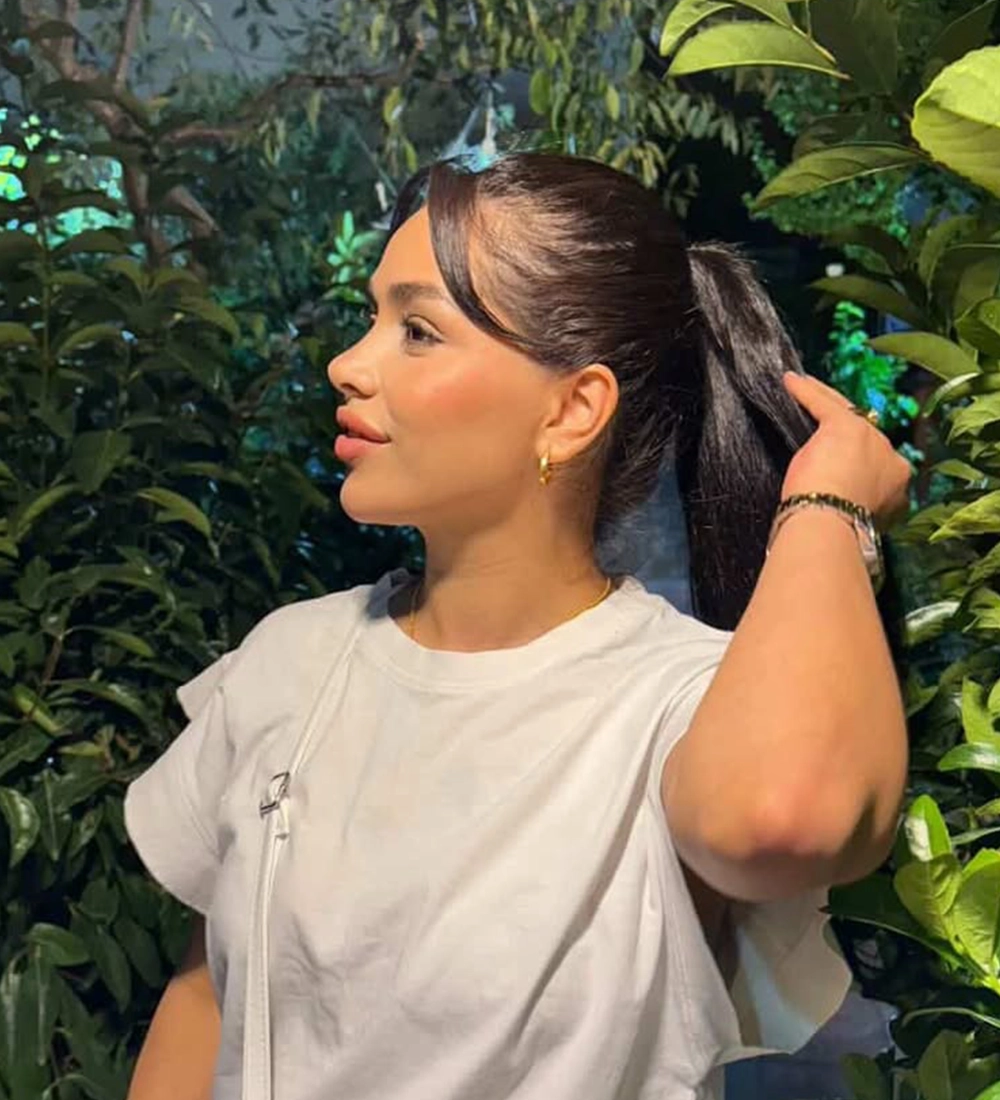Soft natural rhinoplasty result — Op. Dr. Özlem Oymak, Acıbadem Bursa Hospital