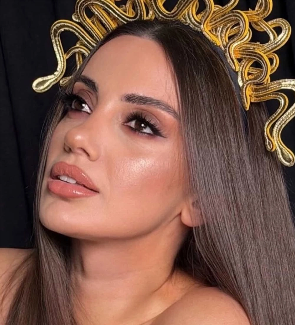 Natural rhinoplasty result — Op. Dr. Özlem Oymak, Acıbadem Bursa Hospital
